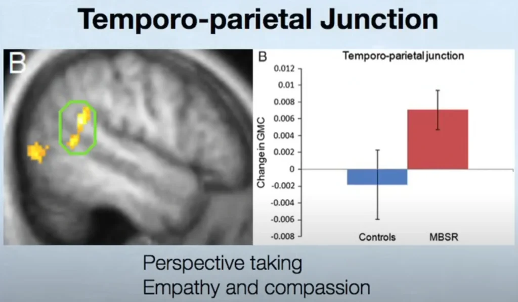 ​Is Meditation Real? Harvard Study Reveals 5 Brain Changes — The MRI-Scanned Truth!